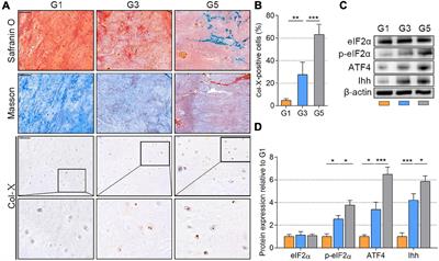 Pharmacological Disruption of Phosphorylated Eukaryotic Initiation Factor-2α/Activating Transcription Factor 4/Indian Hedgehog Protects Intervertebral Disc Degeneration via Reducing the Reactive Oxygen Species and Apoptosis of Nucleus Pulposus Cells